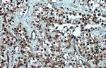 53BP1 Antibody in Immunohistochemistry (Paraffin) (IHC (P))