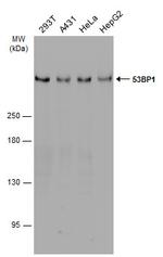 53BP1 Antibody in Western Blot (WB)