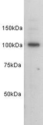 E-cadherin Antibody in Western Blot (WB)