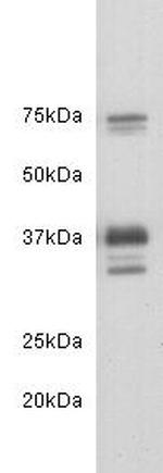 CD24 Antibody in Western Blot (WB)