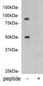 Protein C Antibody in Western Blot (WB)