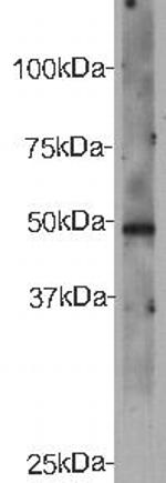 CELSR2 Antibody in Western Blot (WB)