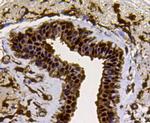 LDHA Antibody in Immunohistochemistry (Paraffin) (IHC (P))