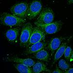 Bax Antibody in Immunocytochemistry (ICC/IF)