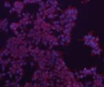 Bax Antibody in Immunocytochemistry (ICC/IF)