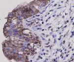 Bax Antibody in Immunohistochemistry (Paraffin) (IHC (P))