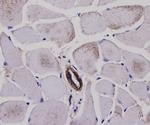 Alpha-Smooth Muscle Actin Antibody in Immunohistochemistry (Paraffin) (IHC (P))