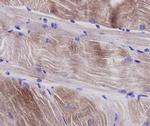 Alpha-Smooth Muscle Actin Antibody in Immunohistochemistry (Paraffin) (IHC (P))