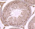 PHF10 Antibody in Immunohistochemistry (Paraffin) (IHC (P))