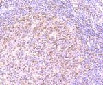 PHF10 Antibody in Immunohistochemistry (Paraffin) (IHC (P))