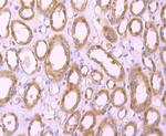 PHF10 Antibody in Immunohistochemistry (Paraffin) (IHC (P))