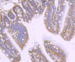 PHF10 Antibody in Immunohistochemistry (Paraffin) (IHC (P))