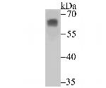 PHF10 Antibody in Western Blot (WB)