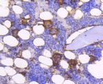 CD61 (Integrin beta 3) Antibody in Immunohistochemistry (Paraffin) (IHC (P))