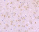 SCN10A Antibody in Immunohistochemistry (Paraffin) (IHC (P))