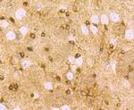 ZIP12 Antibody in Immunohistochemistry (Paraffin) (IHC (P))