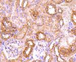 CD71 (Transferrin Receptor) Antibody in Immunohistochemistry (Paraffin) (IHC (P))