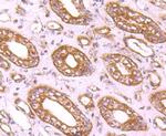 CD71 (Transferrin Receptor) Antibody in Immunohistochemistry (Paraffin) (IHC (P))