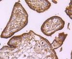 CD71 (Transferrin Receptor) Antibody in Immunohistochemistry (Paraffin) (IHC (P))