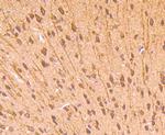 CD71 (Transferrin Receptor) Antibody in Immunohistochemistry (Paraffin) (IHC (P))