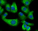 PPM1A Antibody in Immunocytochemistry (ICC/IF)