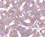 PPM1A Antibody in Immunohistochemistry (Paraffin) (IHC (P))