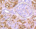 PPM1A Antibody in Immunohistochemistry (Paraffin) (IHC (P))