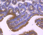 PPM1A Antibody in Immunohistochemistry (Paraffin) (IHC (P))