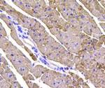 Cardiac Troponin T Antibody in Immunohistochemistry (Paraffin) (IHC (P))