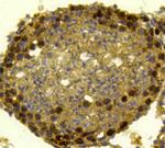 MSH6 Antibody in Immunohistochemistry (Paraffin) (IHC (P))