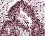 MSH6 Antibody in Immunohistochemistry (Paraffin) (IHC (P))