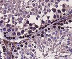 MSH6 Antibody in Immunohistochemistry (Paraffin) (IHC (P))