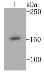 MSH6 Antibody in Western Blot (WB)