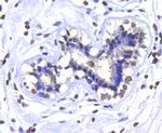 IKK alpha Antibody in Immunohistochemistry (Paraffin) (IHC (P))