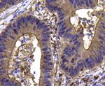 CDK6 Antibody in Immunohistochemistry (Paraffin) (IHC (P))