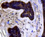 CDK6 Antibody in Immunohistochemistry (Paraffin) (IHC (P))