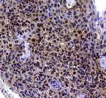 MGMT Antibody in Immunohistochemistry (Paraffin) (IHC (P))