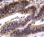 MGMT Antibody in Immunohistochemistry (Paraffin) (IHC (P))