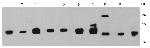 MGMT Antibody in Western Blot (WB)