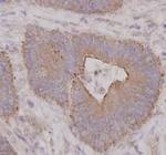 ROCK1 Antibody in Immunohistochemistry (Paraffin) (IHC (P))