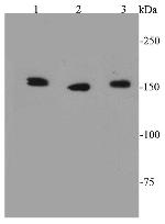 ROCK1 Antibody in Western Blot (WB)