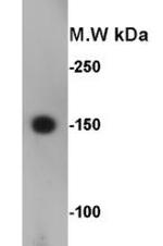 CD56 (NCAM) Antibody in Western Blot (WB)