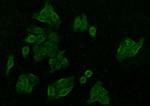 CaMKII delta Antibody in Immunocytochemistry (ICC/IF)