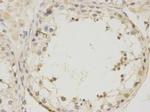 UTF1 Antibody in Immunohistochemistry (Paraffin) (IHC (P))