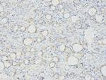 Nucleolin Antibody in Immunohistochemistry (Paraffin) (IHC (P))