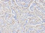 Vimentin Antibody in Immunohistochemistry (Paraffin) (IHC (P))