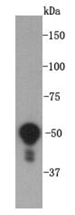 Vimentin Antibody in Western Blot (WB)