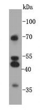 GPR132 Antibody in Western Blot (WB)