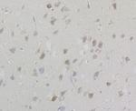 TESPA1 Antibody in Immunohistochemistry (Paraffin) (IHC (P))