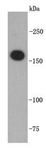 TOP2A Antibody in Western Blot (WB)